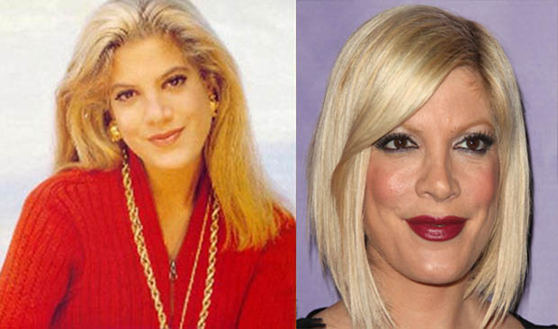 Tori-Spelling-Plastic-Surgery